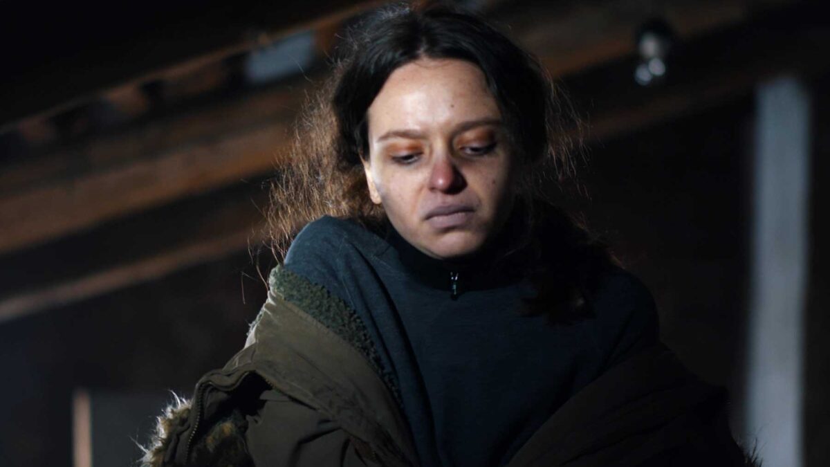 Woman with bruises looks pensive as she tries to find help for meth addiction